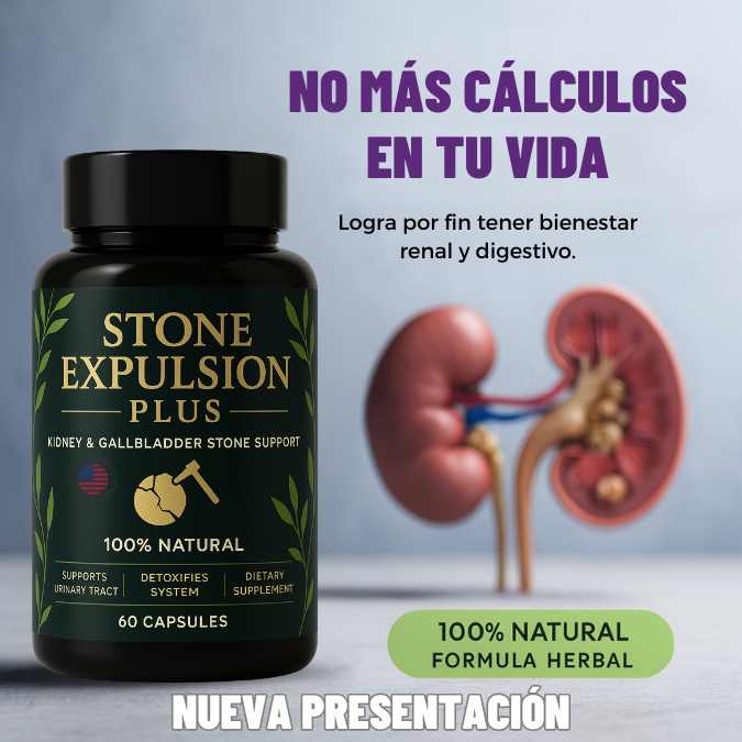 Stone Expulsion Plus: Elimina los cálculos y previene que aparezcan más
