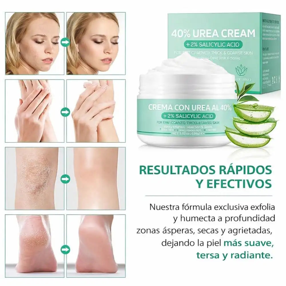 CREMA DE UREA 40% – Repara talones agrietados y suaviza la piel seca