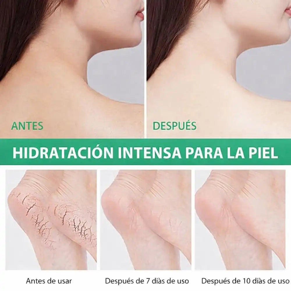 CREMA DE UREA 40% – Repara talones agrietados y suaviza la piel seca