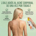 BACK ACNE – Elimina granitos de la espalda y recupera una piel limpia